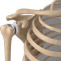 Total Elbow Replacement